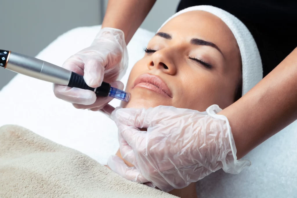 Neurotoxin Injections for Smoother Skin in Pasadena, CA